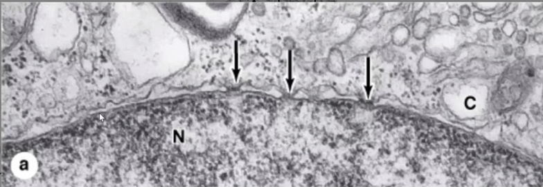 <p>Identify the following structures in electron micrograph</p>