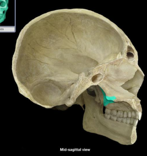 <p>What bone is this?</p>