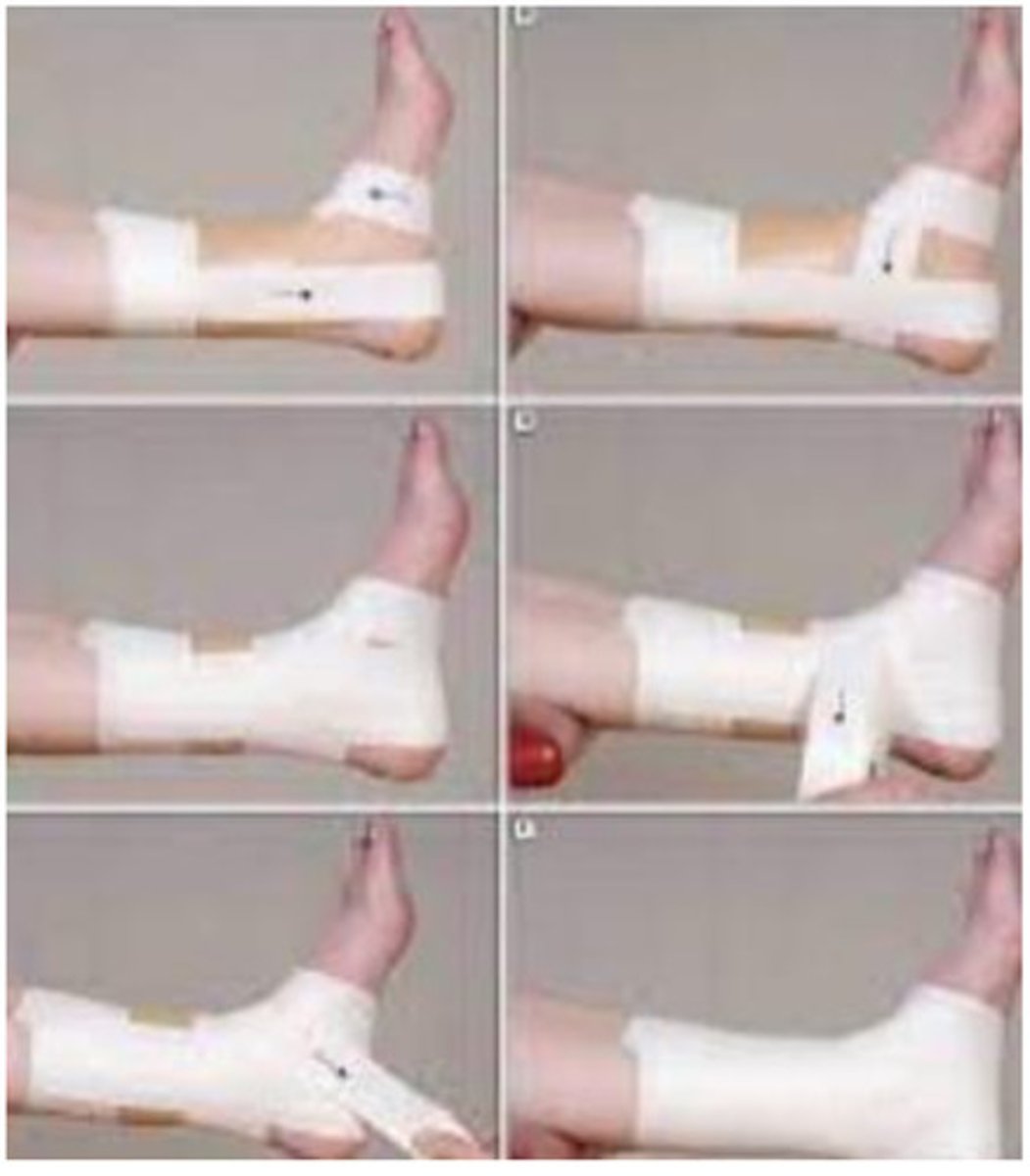 <p>Goal: support the ankle joint and prevent inversion.</p>