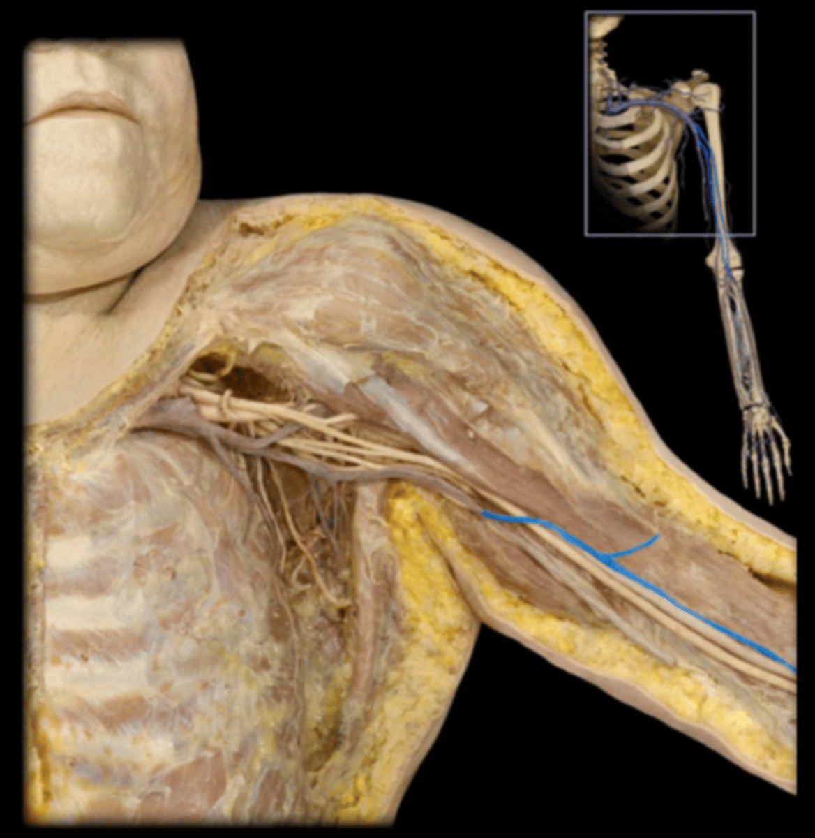 <p>Paired deep veins that run with the brachial artery</p>