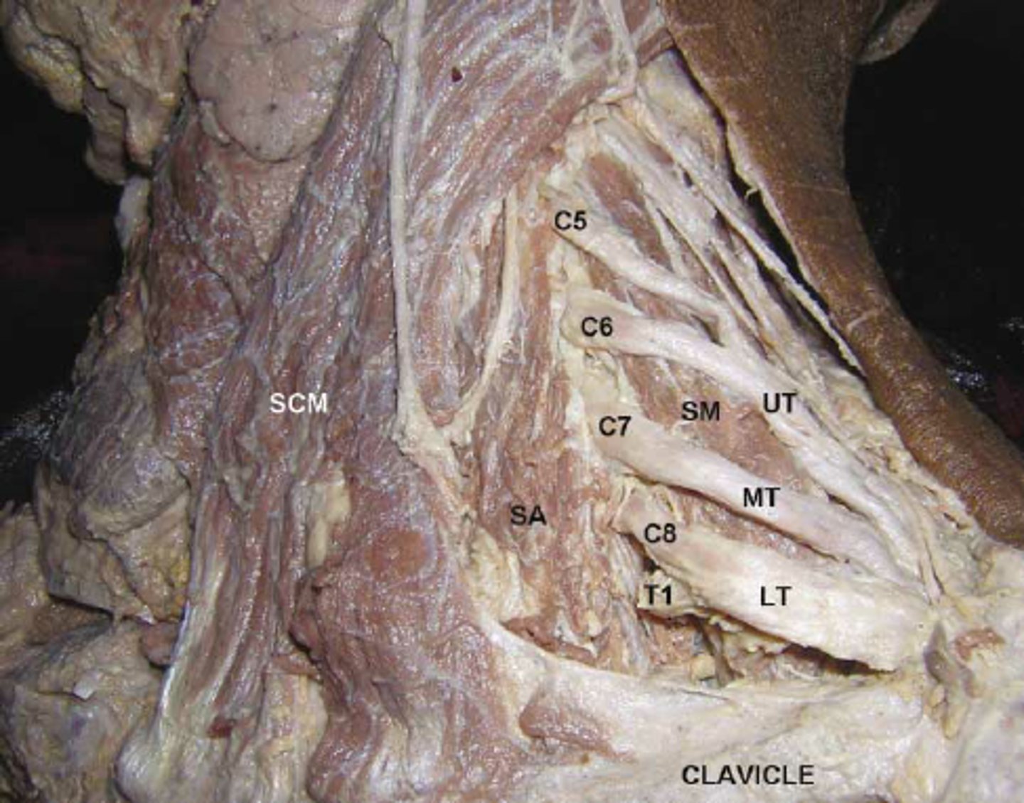 <p>C5-C6</p>