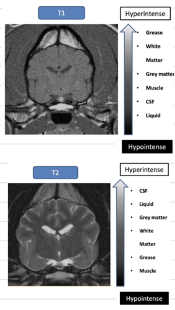 <p>T1: used to see normal anatomy, white matter is light and grey matter is dark grey, liquid is dark</p><p>T2: used to see abnormal structures, white matter is dark grey and grey matter is light, liquid is bright</p>