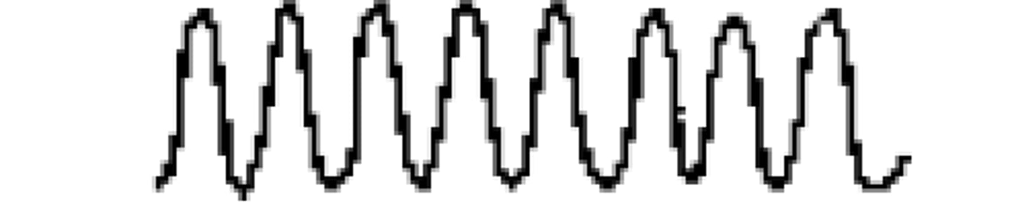 <p>rapid and deep respirations</p>