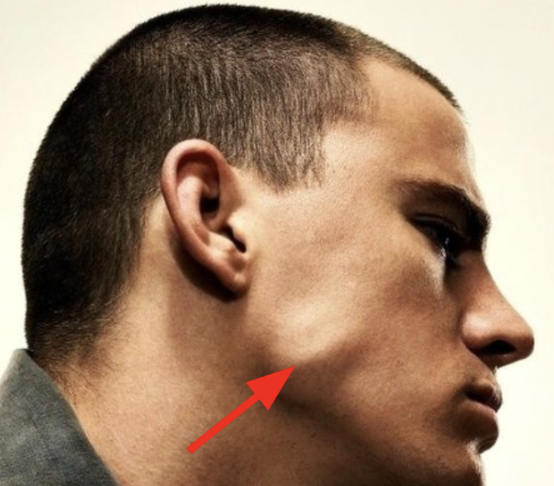 <p>What muscle is being shown?</p>