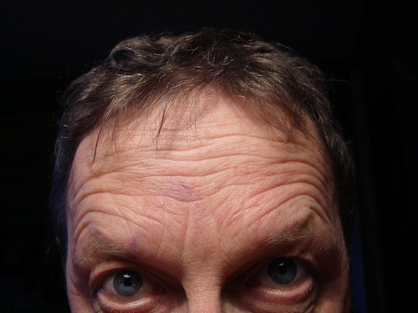 <p>forehead</p>