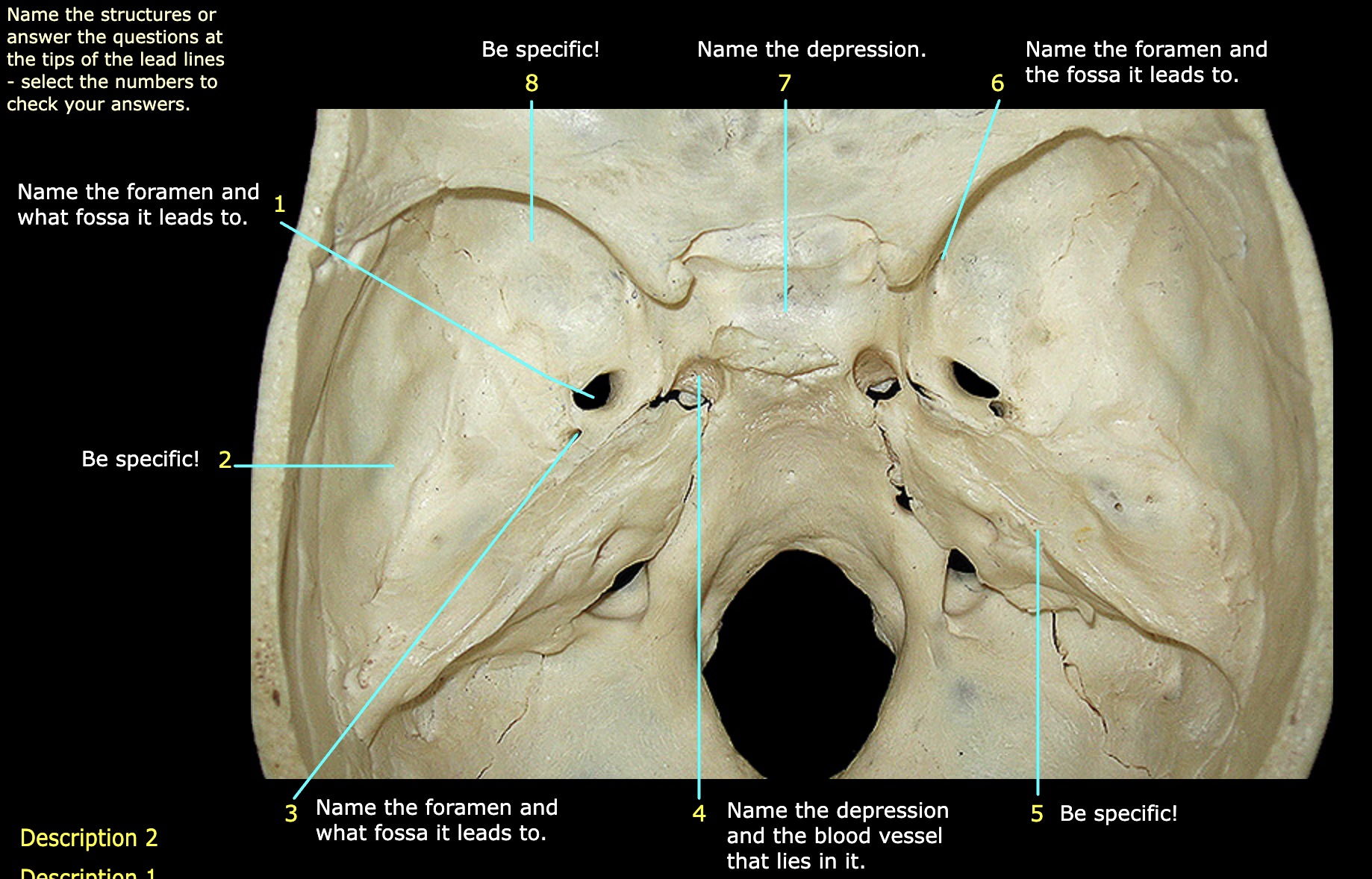 What structure is labeled 4? (read the picture, be specific)