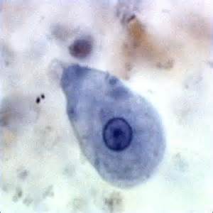<p>Which protist is this? </p>