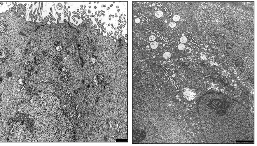 <p>Where is this epithelium</p>