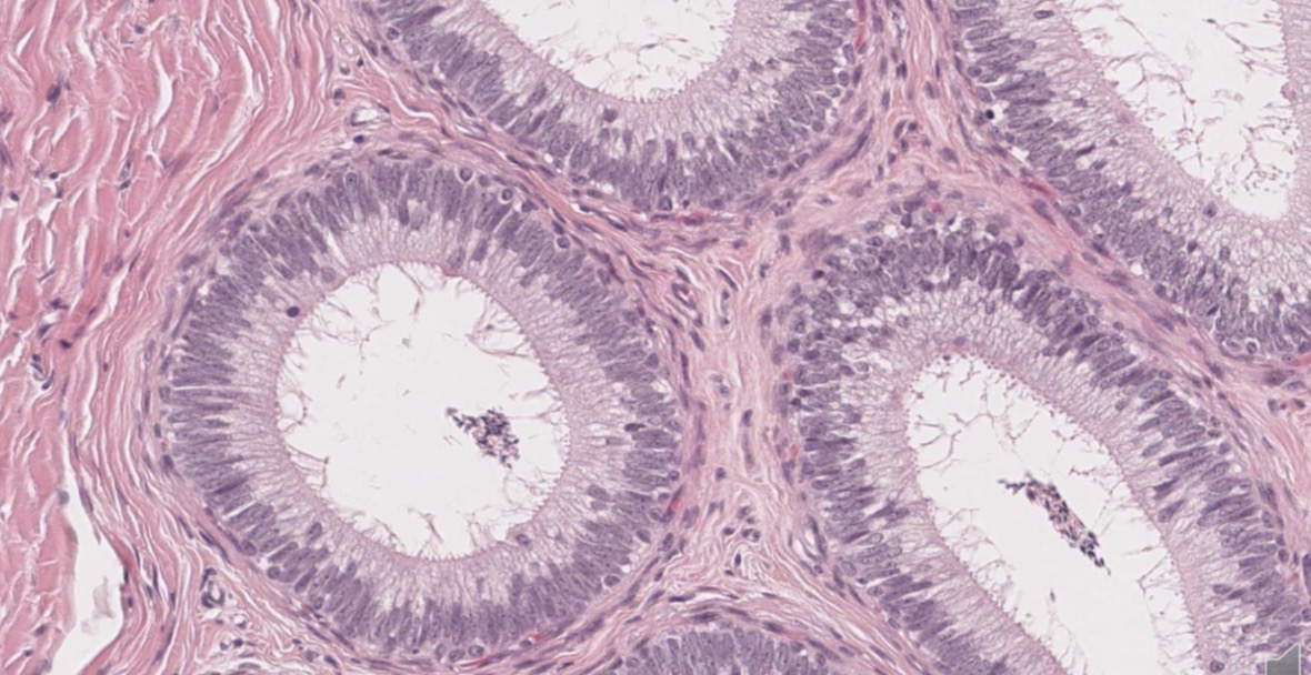 <p>Epitelio pseudoestratificado cilíndrico con microvellosidades largas</p>