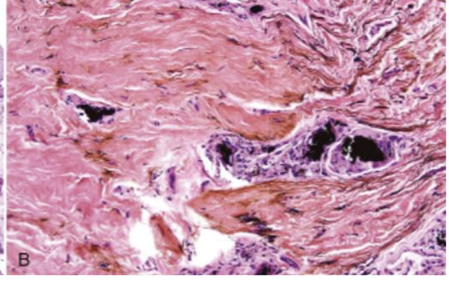 <p>What are the black particles embedded in the purple?</p>