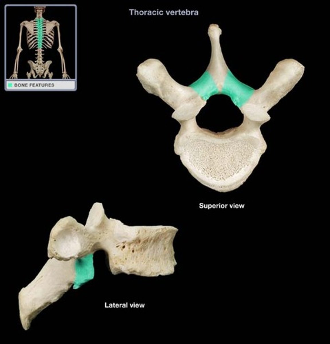 <p>thin, plate like area between the spinous and transverse processes.</p>
