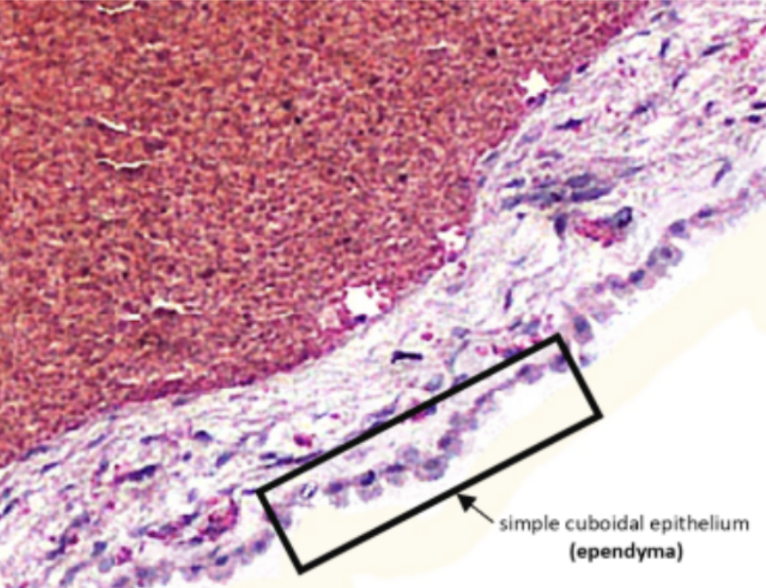 <p>What specimen is shown in this slide?</p>