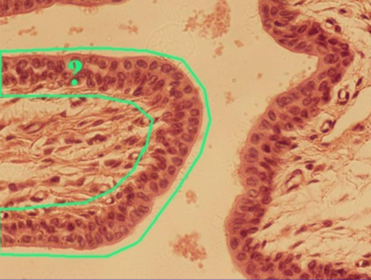 <p>several layers of tall cells</p><p>Location: Male urethra and large ducts of some glands</p><p>Function: Protection and secretion</p>