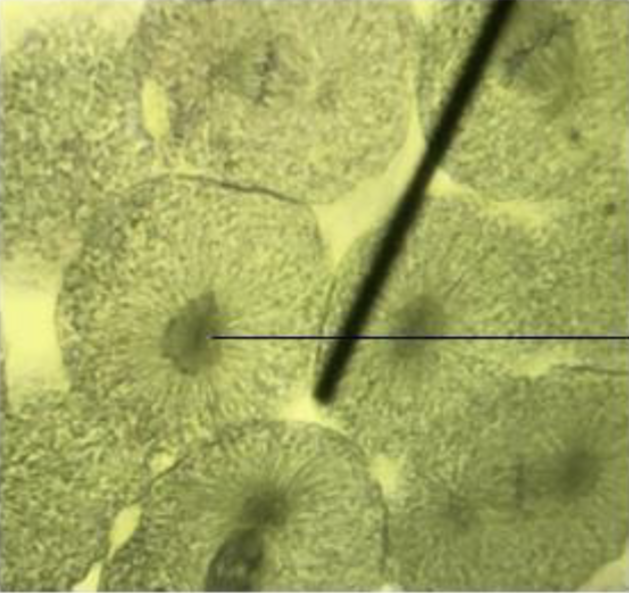 <p>What is the phase of the cell? What do the pointers point to?</p>