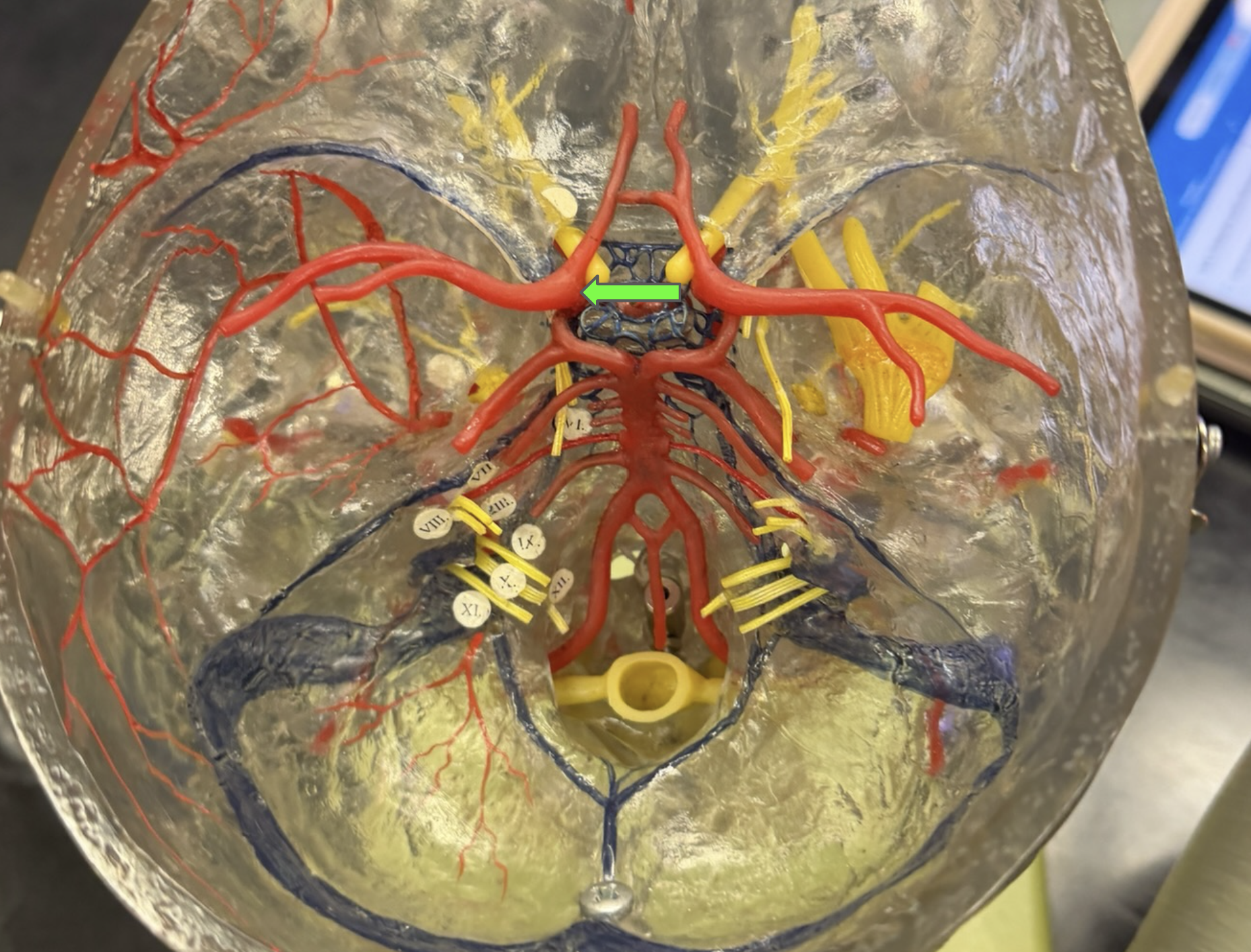 <p>What is this?</p>