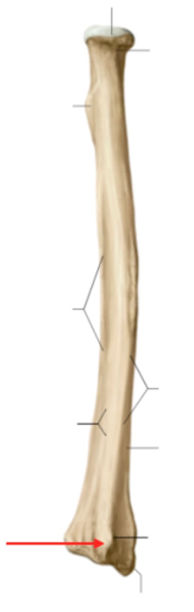 <p>Huge tubercle on the posterior of the distal radius.</p>