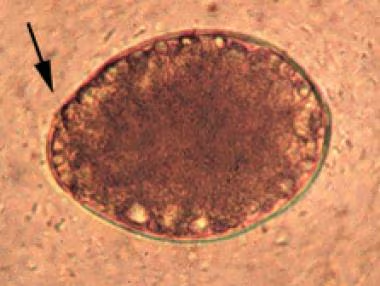 <p>60 micrometers (average)</p>