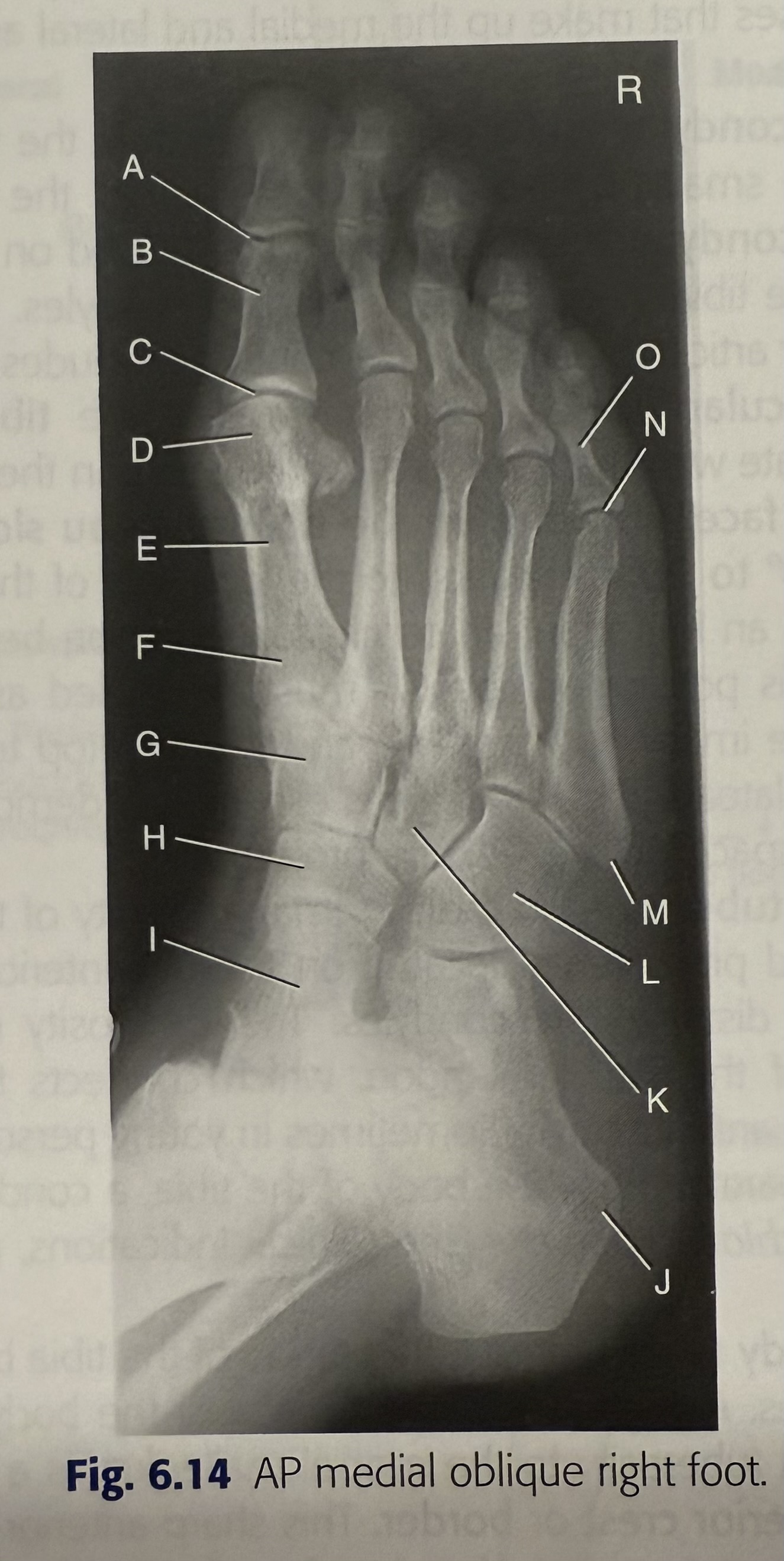 <p>C</p>