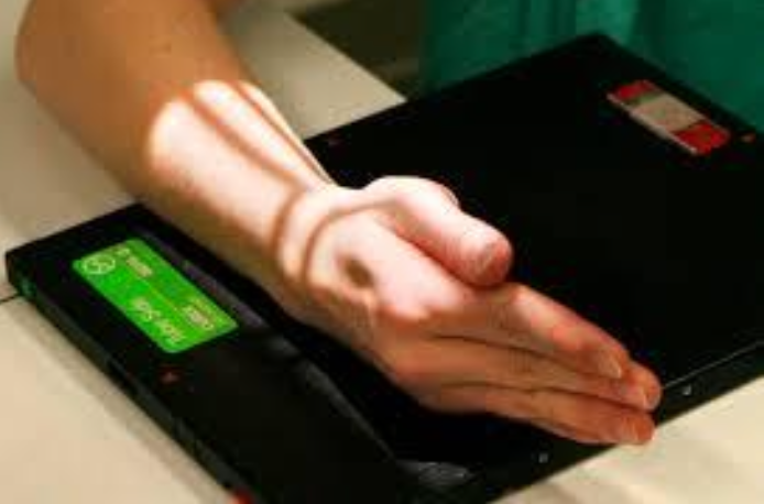 <p>lateral (wrist)</p>