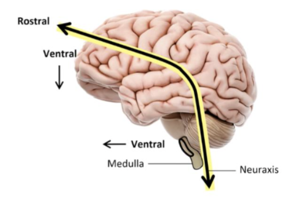 <p>Dorsal - top of neuraxis</p><p>Ventral - bottom of neuraxis</p><p>Rostral - front</p><p>Caudal - back</p>