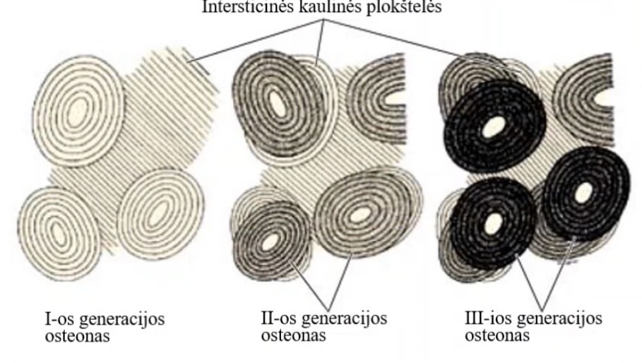 <ul><li><p>pirmos generacijos osteono Haversono kanalas is vidines puses yra praardomas</p></li><li><p>Kraujagysles pasislenka i sona ir osteoblastocitai pradeda naujai gaminti ploksteles aplink haversono kanala</p></li></ul><p></p><ul><li><p>sviesios intersticines ploksteles - senos, o tamsios jaunos</p></li><li><p>Tamsus osteonai - jauni, sveisus - seni</p></li></ul><p></p>