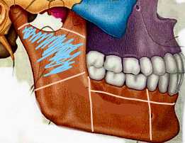 <p>What part of the mandible?</p>