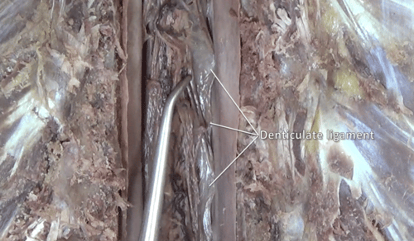 <p>extensions of pia mater that secure cord to dura mater</p>