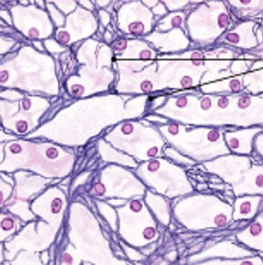<p>Which type of connective tissue has:</p><ul><li><p>Complex, 3-dimensional network</p></li><li><p>Supportive fibers, support functional cells</p></li><li><p>Reticular organs:</p><ul><li><p>spleen, liver, lymph nodes, and bone marrow</p></li></ul></li></ul><p></p>