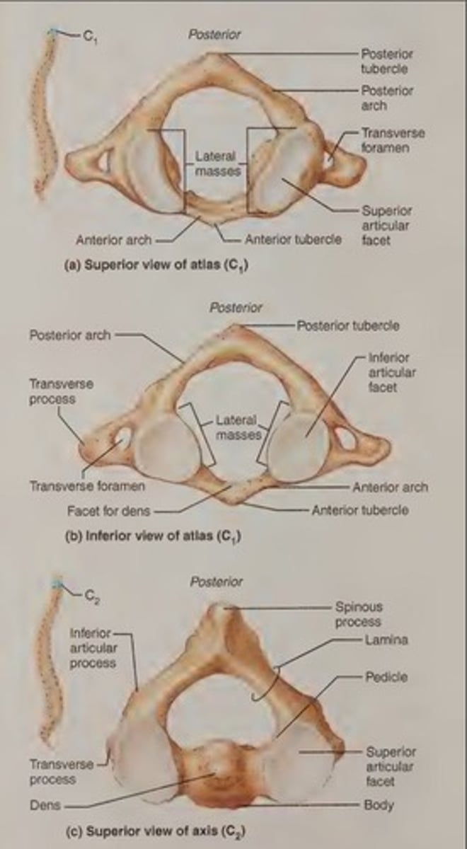 <p>Lacks a body, and its lateral process contains large concave depressions on their superior surfaces that receives the occipital condyles of the skull.</p>
