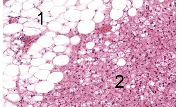 <p>Mỡ trắng cục mỡ chà bá màu trắng</p><p>Mỡ nâu chia thành nhiều cục mỡ nhỏ, bắt màu nhuộm do có nhiều ti thể và mao mạch phong phú</p>
