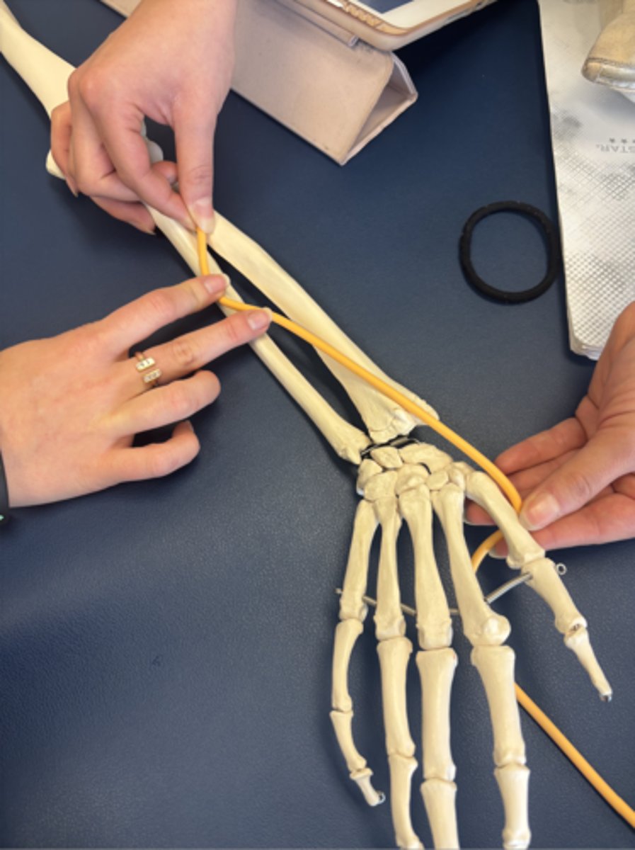 <p>What is this muscle?</p>