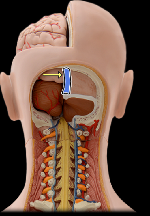<p>Superior sagittal sinus</p>