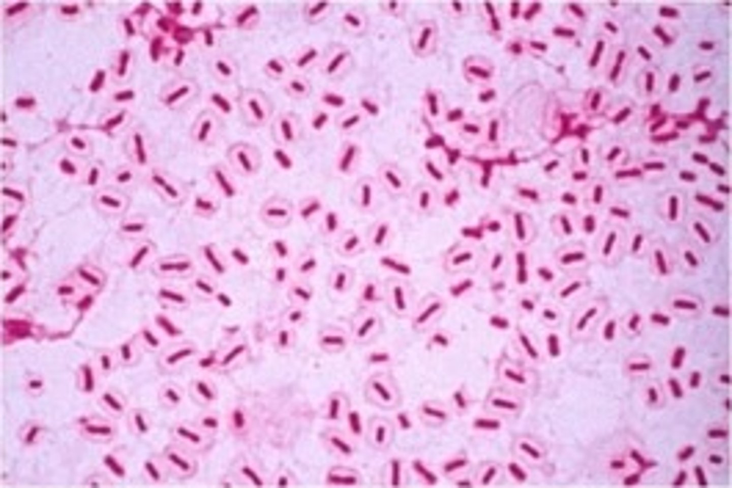 <p>Gram negative rods with capsule</p><p>Causes UTIs, pneumonia, wound infections, otitis externa, septicaemia</p><p>Affects respiratory, urinary, skin, systemic</p>