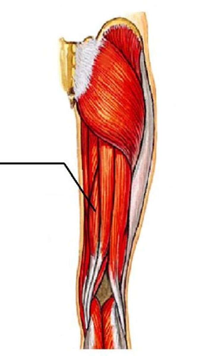 <p>Flexes leg at the knee and extends thigh at the hip; belongs to the hamstring group</p>
