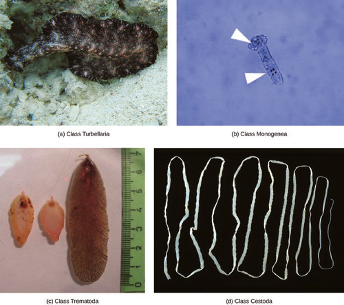 <p>Platyhelminthes</p>