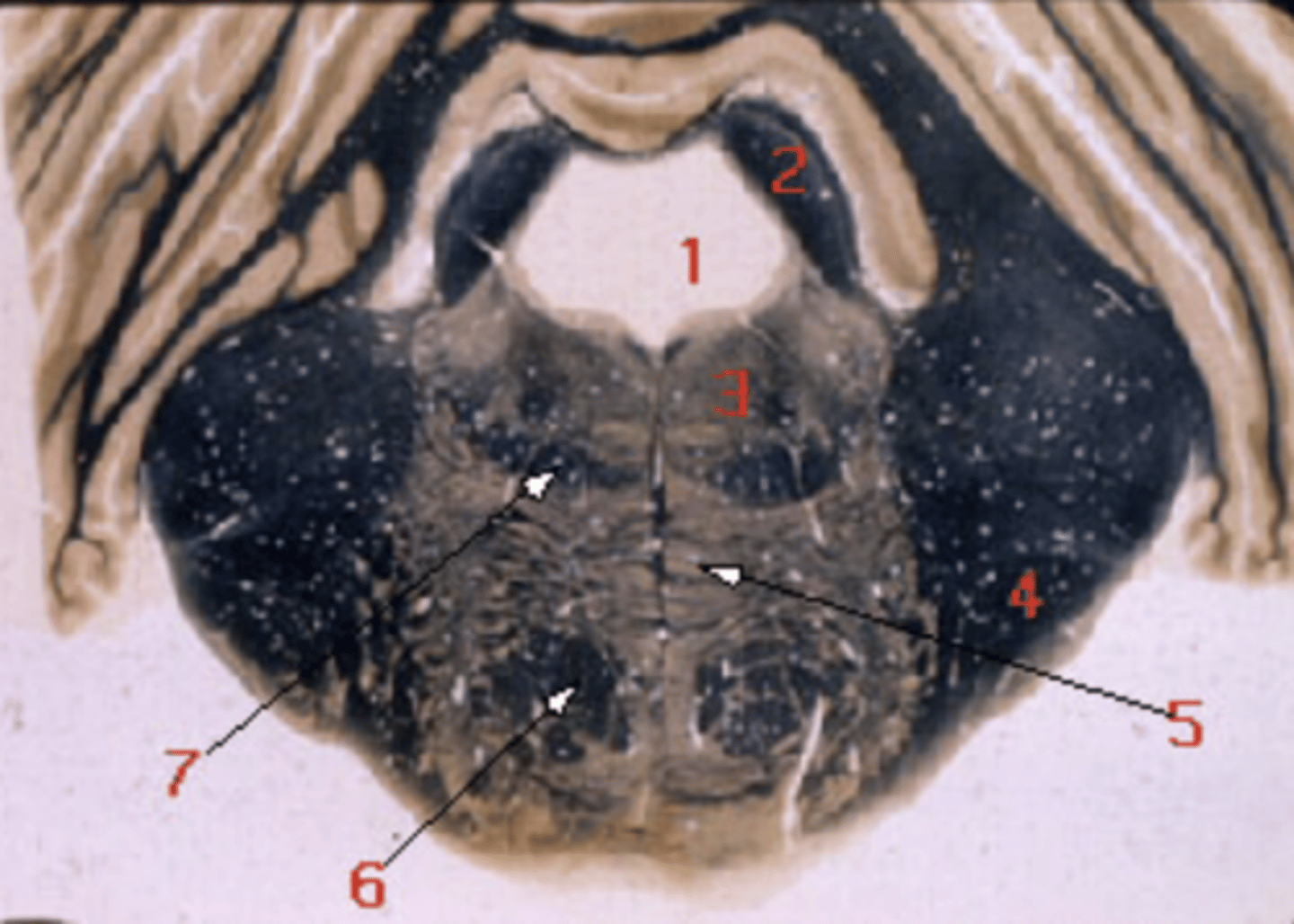 <p>middle cerebellar peduncle</p>