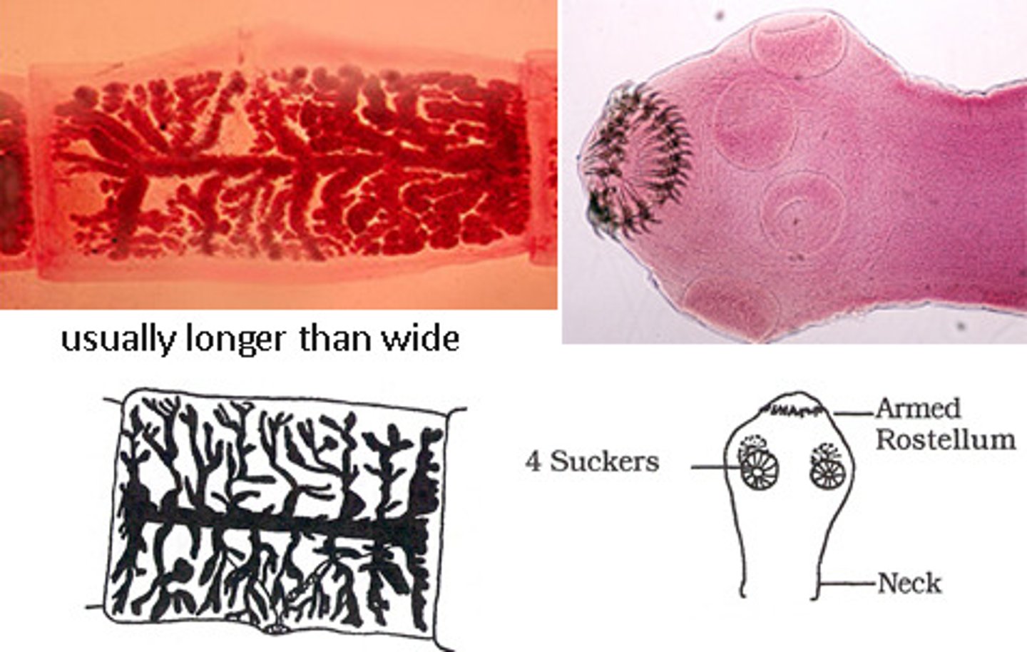 <p>• Eggs are identical to T. saginata</p><p>• Worm</p><p>o Scolex with four suckers with armed</p><p>rostellum</p><p>o Proglottids</p><p>Longer than they are wide</p><p><13 uterine branches</p>