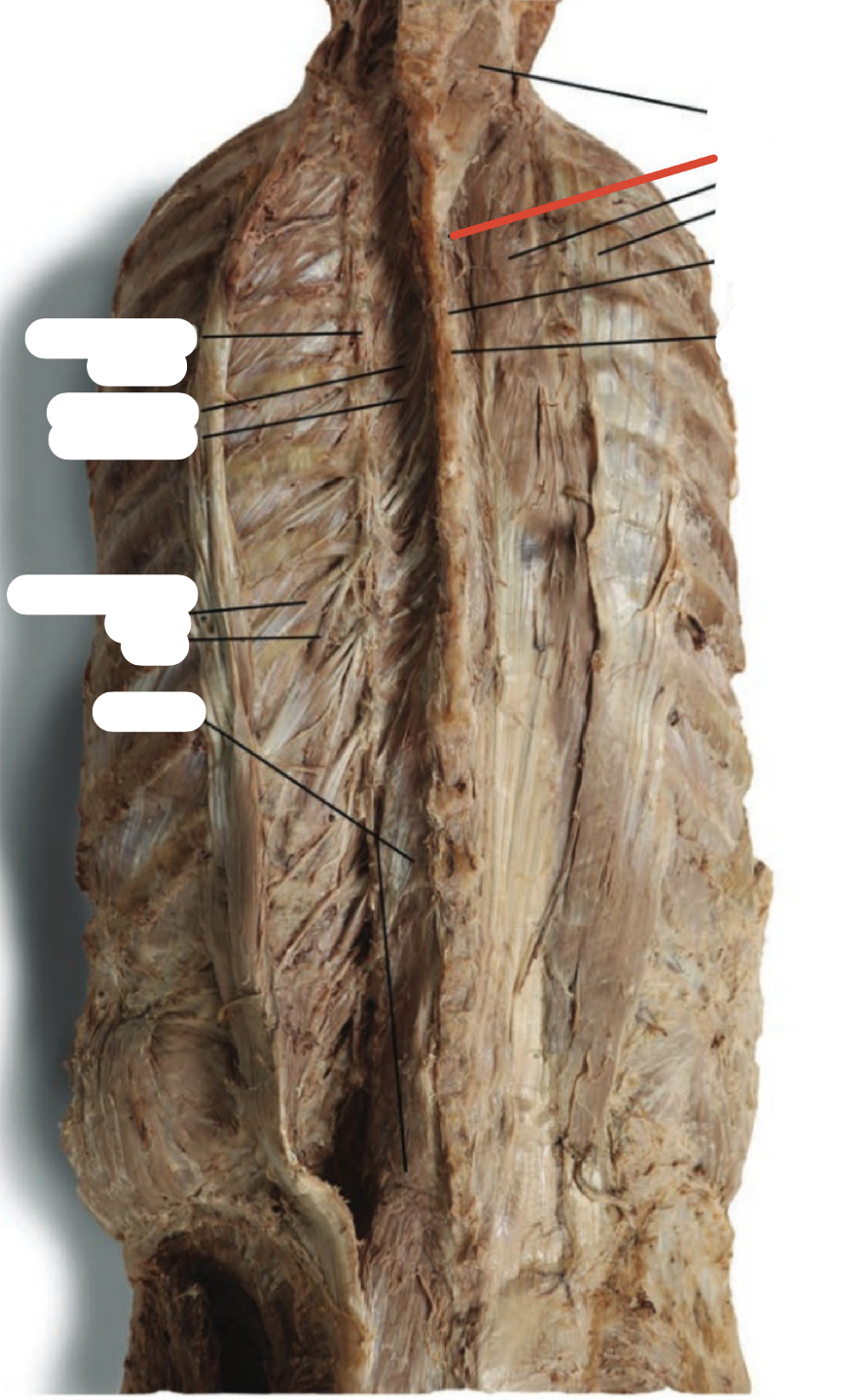 Identify the structure (red line)