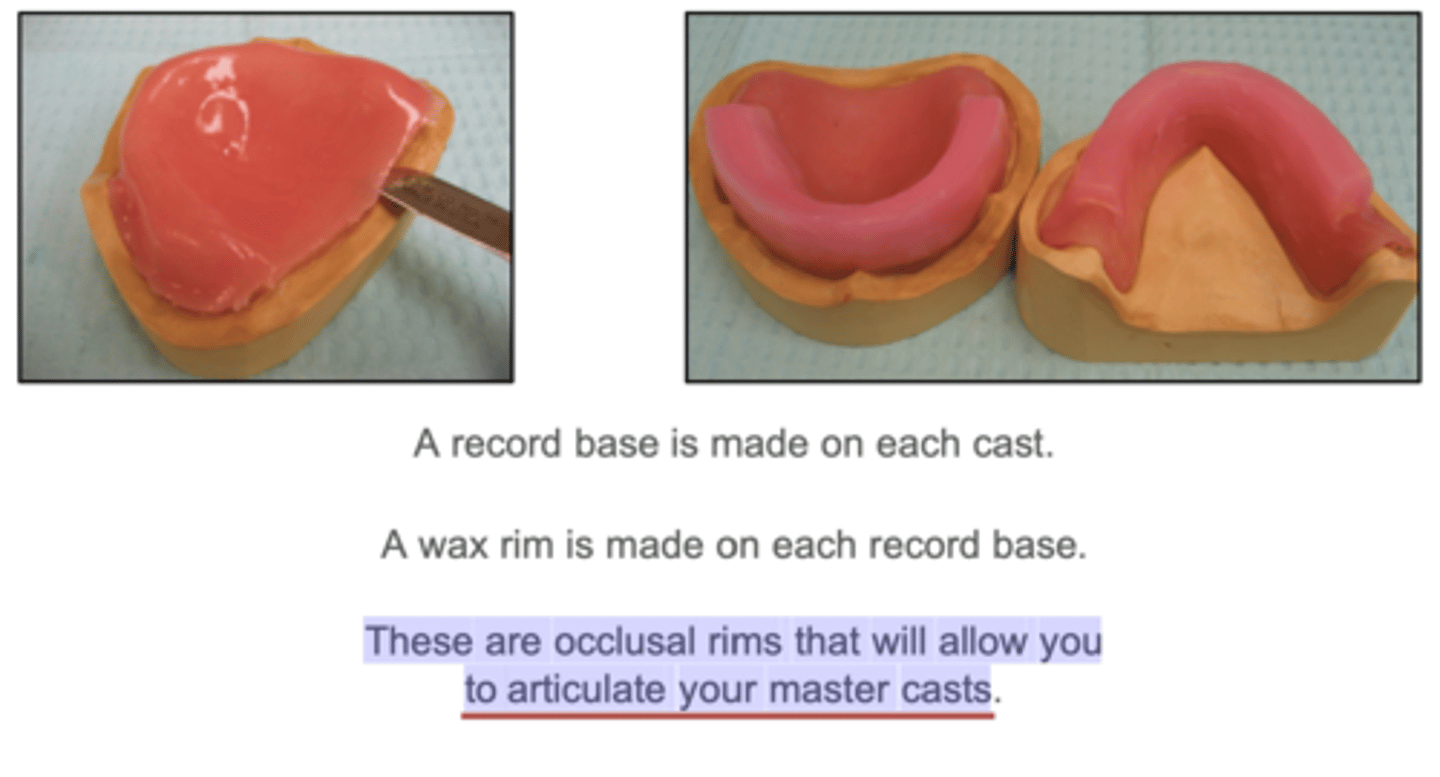 <p>These are occlusal rims that will allow you to articulate your master casts</p>