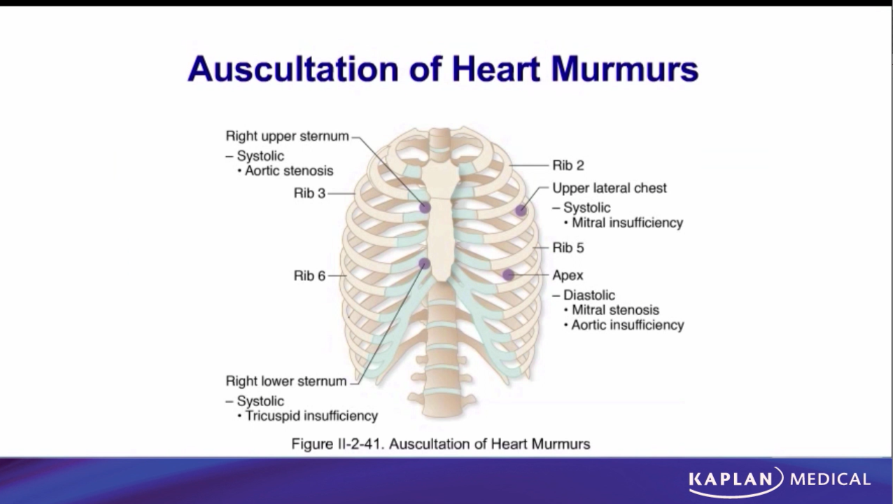 <p>+tricuspidal stenosis - 5 intercostal space on the left</p><p>dyastolic murmurs - tricuspial, mitral stenosis + aortic and pulmonary valves insufficiency</p><p>systoic murmurs - tricuspial, mitral insufficiency+ aortic and pulmonary valves stenosis</p>