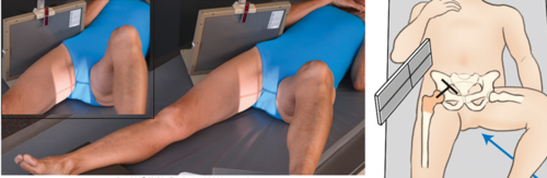 <p>If no fracture suspected and pt able → frog leg hip</p><p>If fracture suspected → cross-table hip aka Danelius-Miller method (shoot straight into the crotch)</p>