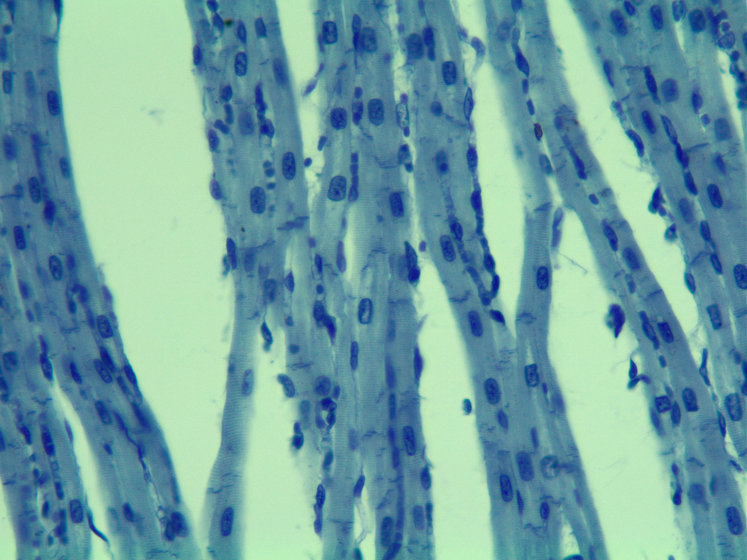 <p>Cardiac muscle contains</p>