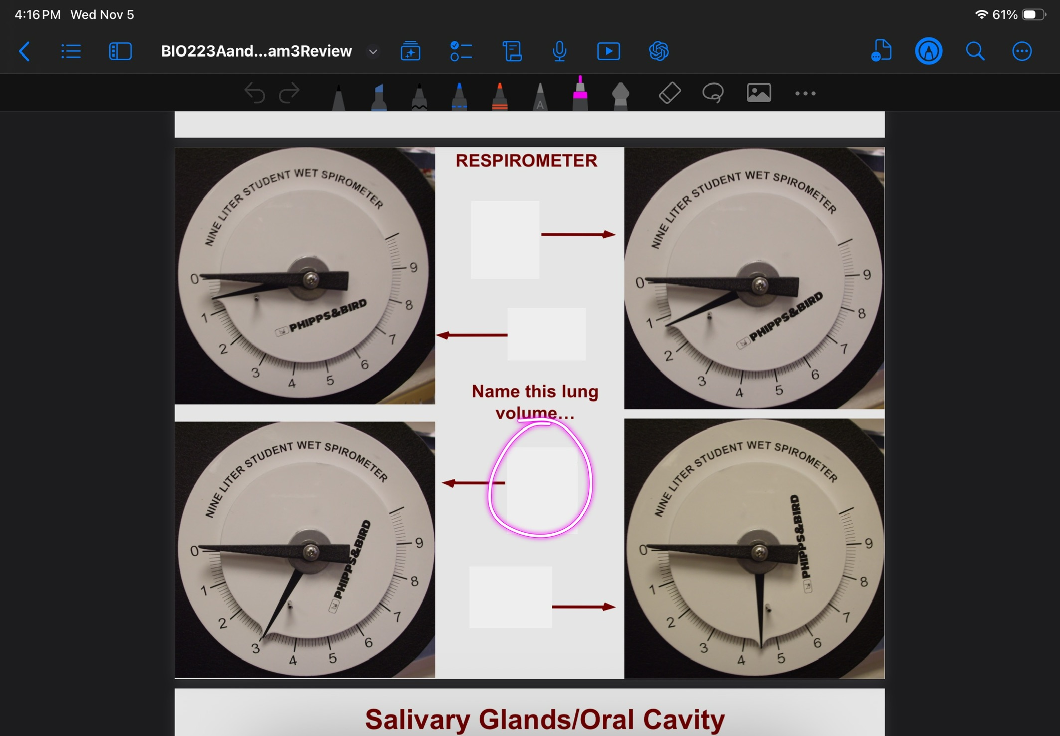 <p>Lung volume of IRV</p>