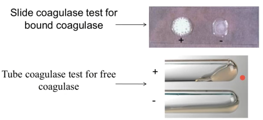 <p>coagulase identification test, taking the bacteria samples on slide, mixed with rabbit plasma/serum, then put into tube. If S. aurus will produce coagulase making a blood clot like gel at the bottom of the tube </p>