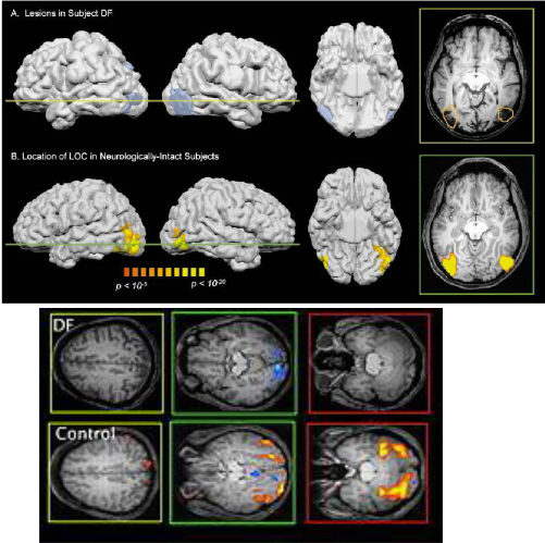 <p>the occipital cortex</p><p></p>