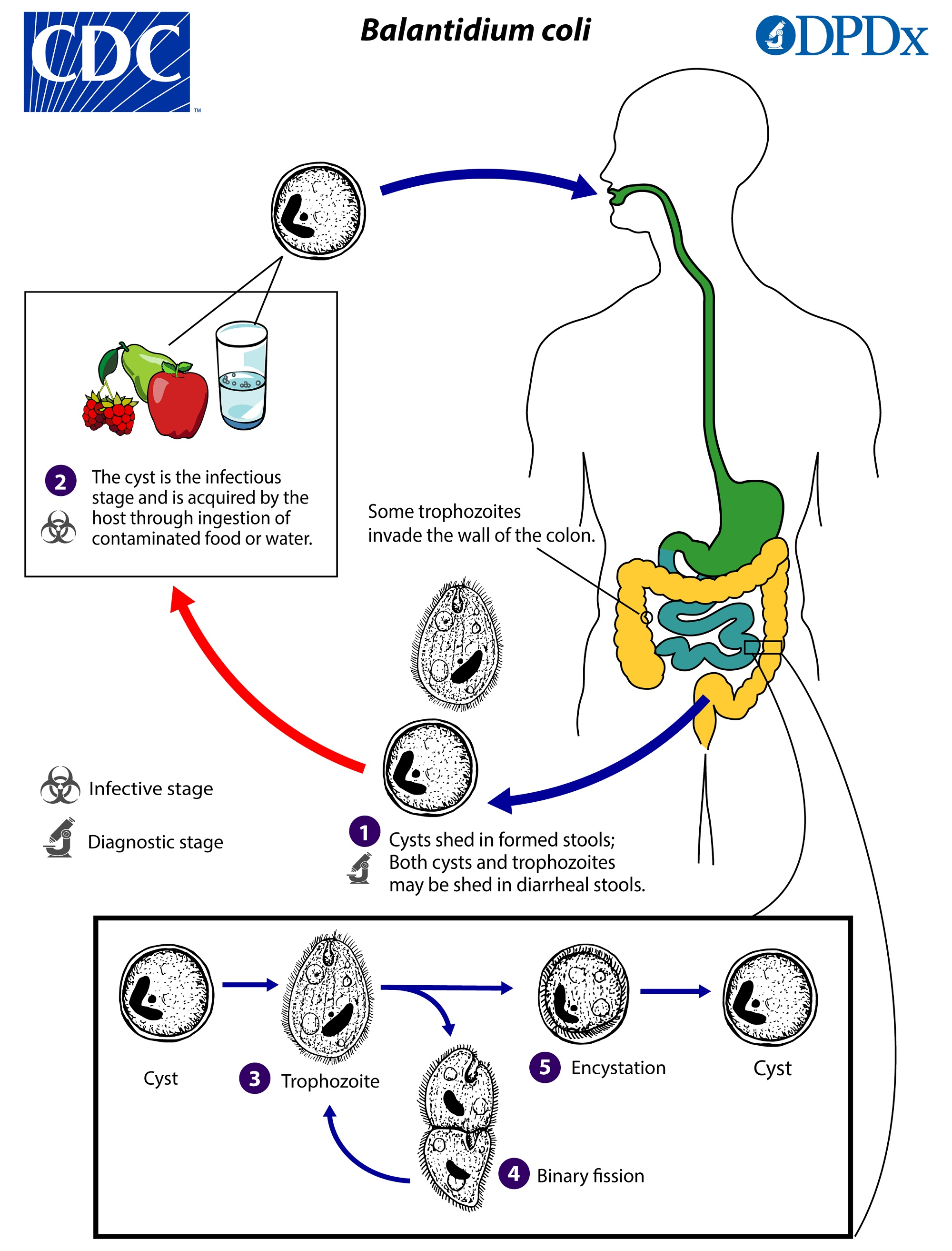 <p> <strong>pathogenic</strong> </p><ul><li><p><strong>Type</strong>: <strong>Ciliate</strong> (largest protozoan of humans)</p></li><li><p><strong>ID</strong>: <strong>Troph 50–100 μm</strong> with <strong>cilia</strong>, <strong>macronucleus (+ micronucleus)</strong>, <strong>cytostome</strong>; <strong>cyst 50–70 μm</strong> with thick wall, macronucleus, +/- cytostome, <strong>no cilia</strong>.</p></li><li><p><strong>Host/site/lifecycle</strong>: Humans, close association with <strong>pigs</strong>; colon/cecum; ingest <strong>cysts</strong> from contaminated food/water.</p></li><li><p><strong>Symptoms</strong>: Asymptomatic to chronic non-bloody diarrhea; <strong>fulminant disease</strong> causes <strong>mucoid, bloody stools</strong>, weight loss, explosive diarrhea; <strong>flask-shaped lesions</strong> and <strong>perforation</strong> possible (<strong>hyaluronidase</strong> implicated).</p></li><li><p><strong>Bloody stool?</strong> <strong>Yes</strong> (in severe disease).</p></li><li><p><strong>Risk</strong>: Poor sanitation, alcoholism, malnourishment, immunocompromise.</p></li></ul><p></p>