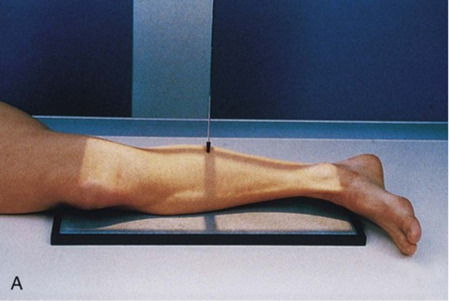 <p>1. From the AP position, the patient turns onto the affected side. Lateral aspect of the leg in contact with the IR.</p><p>2. The knee joint is flexed.</p><p>3. The malleoli should be superimposed (in practice the toes are slightly elevated). The condyles of the knee should also be superimposed.</p><p>4. The foot is dorsi-flexed (bringing the plantar aspect 90° to the image detector).</p><p>5. The long axis of the tibia should be parallel to the image detector.</p>