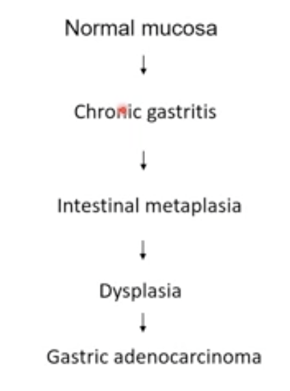 <ul><li><p>ABs against parietal cells and intrinsic factor</p></li><li><p>Intestinal metaplasia because cells try to replace the missing ones but differentiate into intestinal cells instead</p></li><li><p>Neuronal-endocrine cell hyperplasia because G cells keeps stimulating production of acid</p></li><li><p>Loss of intrinsic factor = No uptake of B12 = Anemia</p></li><li><p>Increased risk for adenocarcinoma and neuroscience-endocrine tumour</p></li></ul>