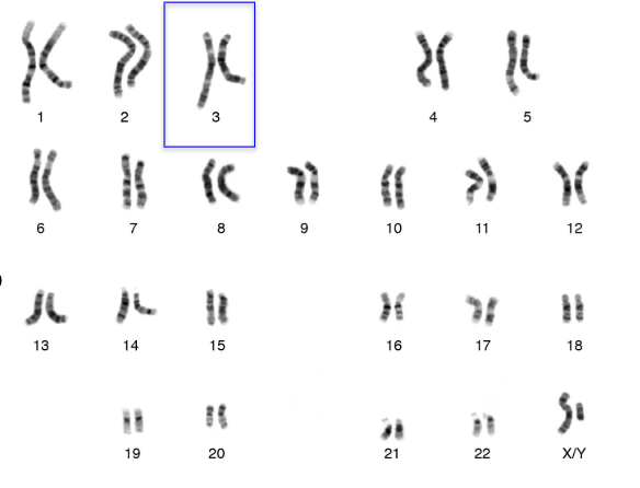<p><span>How many chromosomes and DNA molecules are in the blue box?</span></p><p><span style="line-height: 15pt;">2 homologous chromosomes, 4 molecules of DNA</span></p><p><span style="line-height: 15pt;">4 homologous chromosomes, 2 molecules of DNA</span></p><p><span style="line-height: 15pt;">1 homologous chromosome, 2 molecules of DNA</span></p><p><span style="line-height: 15pt;">1 homologous chromosome, 4 molecules of DNA</span></p>