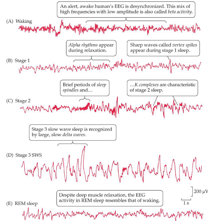 <p>Wakefulness, stage 1 sleep EEG, stage 2 sleep EEG, stage 3 sleep EEG</p>